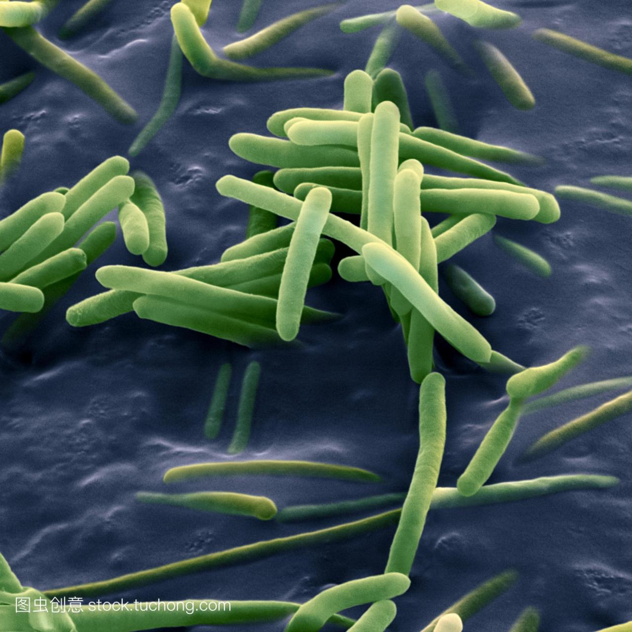 芽孢杆菌sphaericus彩色扫描电子显微摄影SE