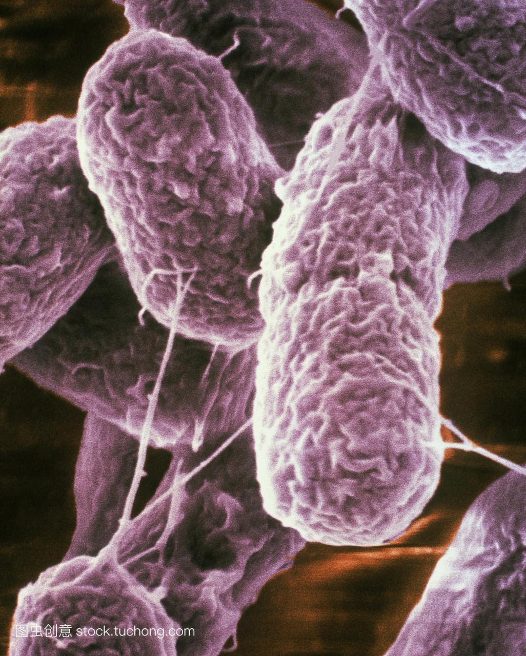 SEM的大肠杆菌H15707细菌,食物中毒的原因。