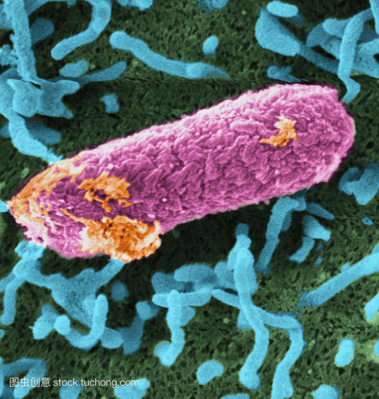 菌h15707细菌的彩色扫描电子显微镜sem,是食