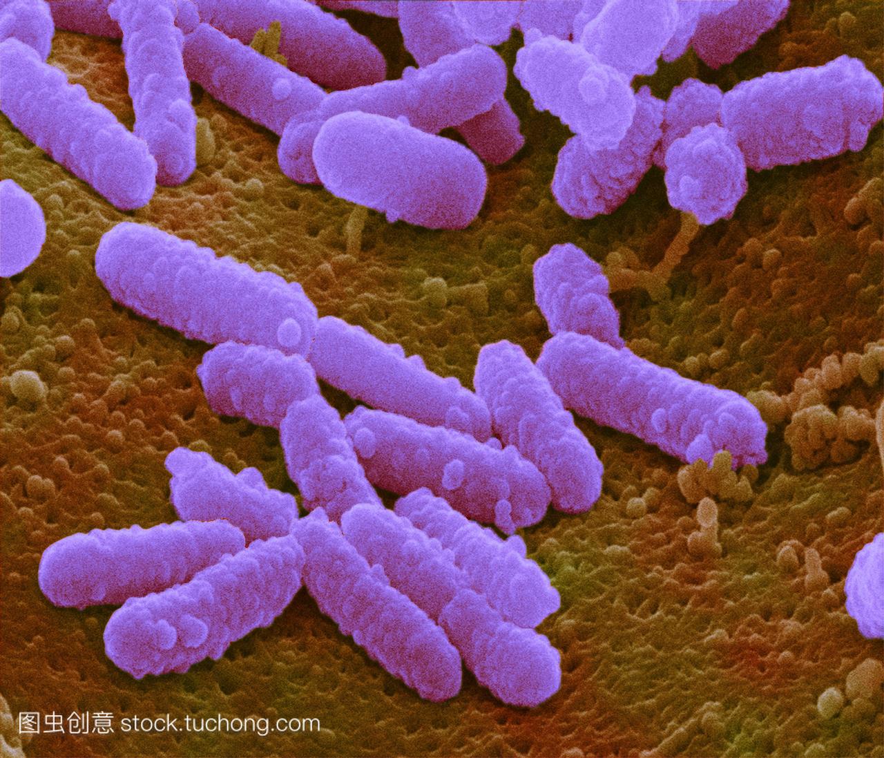 大肠杆菌的细菌。彩色扫描电子显微镜sem的大