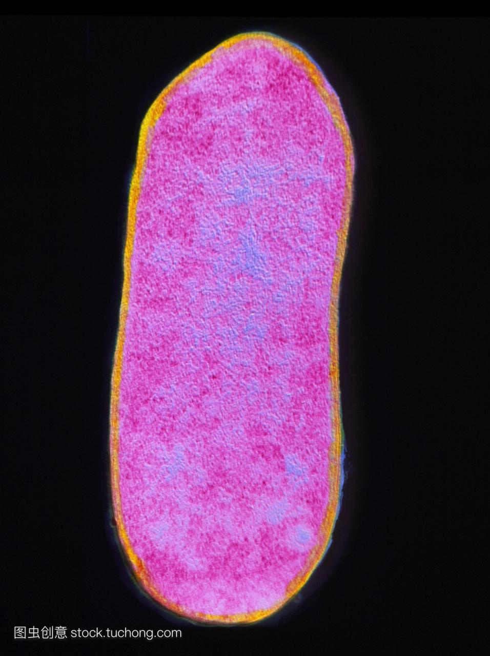 伪彩色透射电子显微镜TEM伤寒沙门氏菌革兰