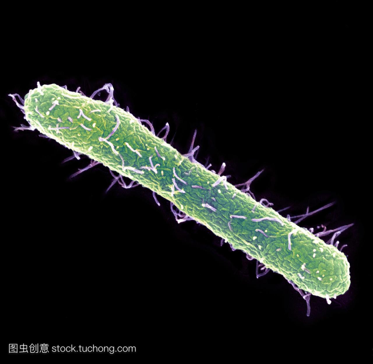 鼠伤寒沙门氏菌的细菌彩色扫描电子显微摄影S