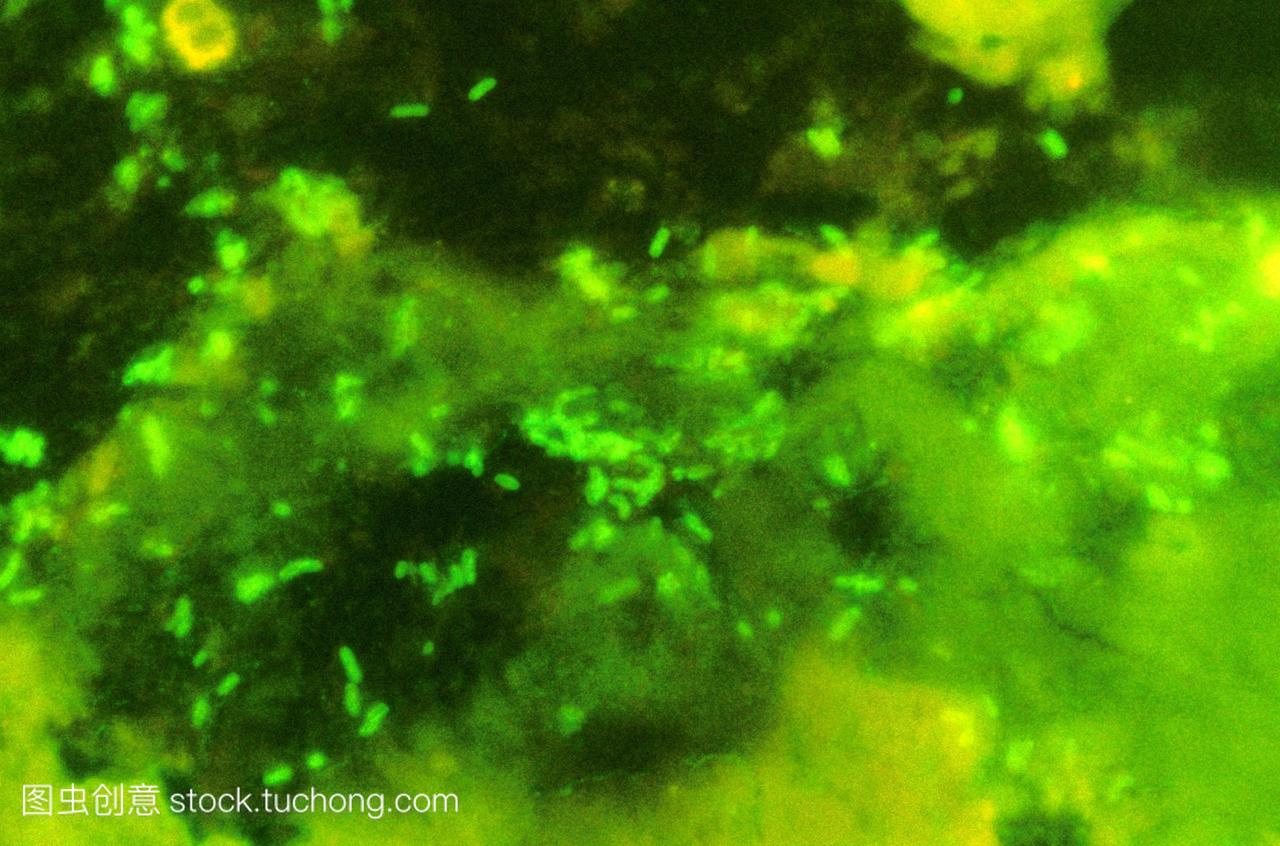大肠杆菌。大肠杆菌细菌的荧光显微照片亮绿色