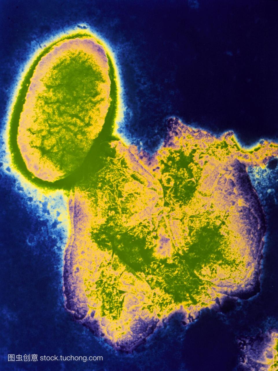 伪彩色透射电子显微照片的细菌流感嗜血杆菌椭