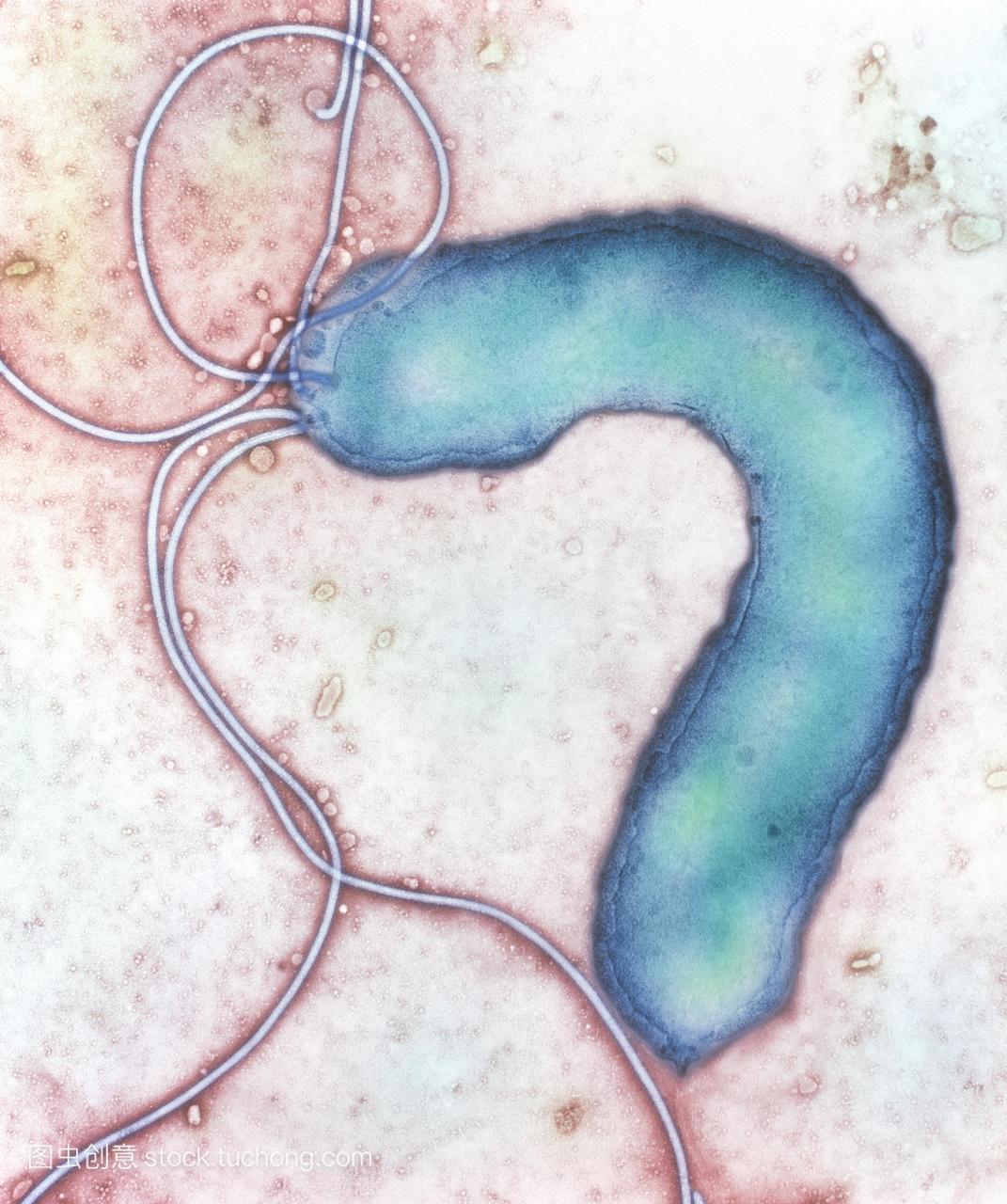 幽门螺旋杆菌细菌。彩色反式-任务电子显微镜