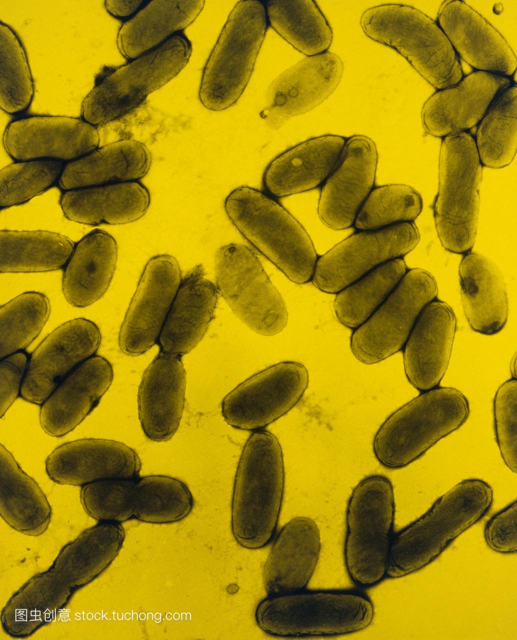 假彩色透射电子显微照片的百日咳杆菌百日咳博