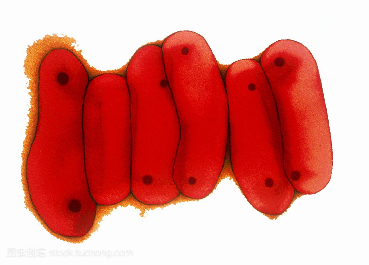 细菌rodshaped细菌是人类结核病的主要原因如