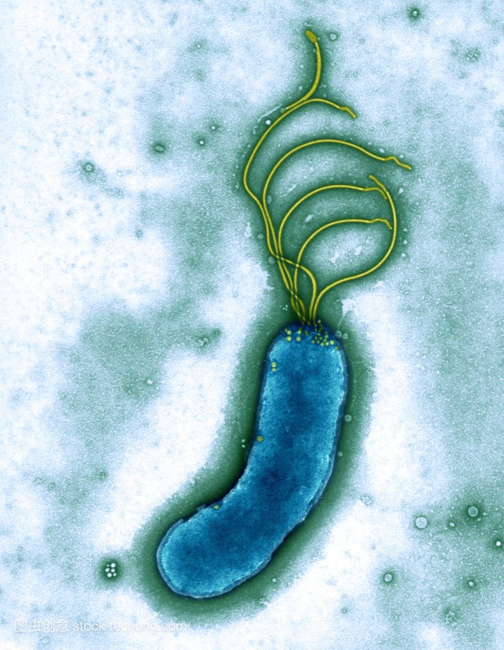 幽门螺旋杆菌细菌彩色透射电子显微镜TEM。