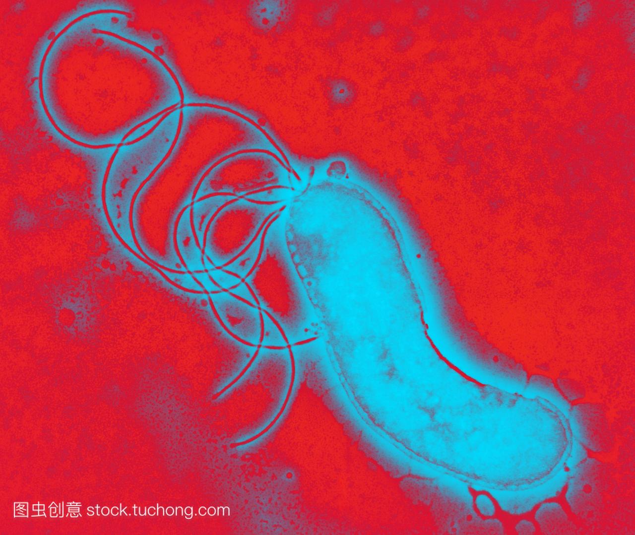 幽门螺杆菌,彩色透射电子显微镜tem。这部分通