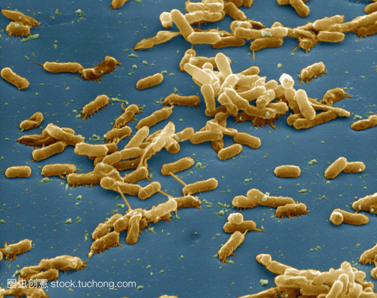 大肠杆菌的细菌。一簇大肠杆菌的彩色扫描电子