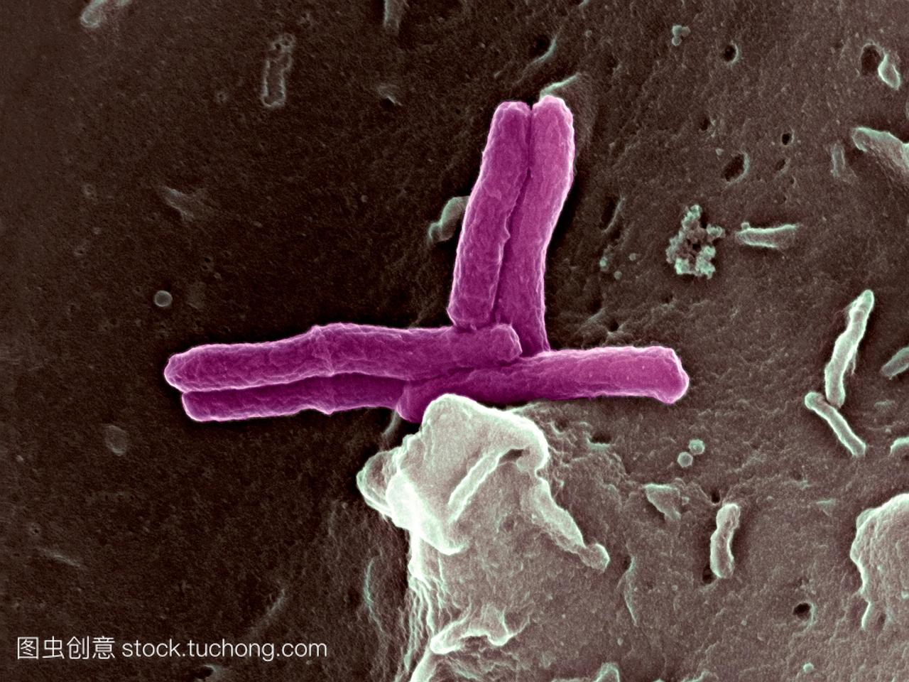 细菌感染巨噬细胞。彩色扫描电子显微镜sem的