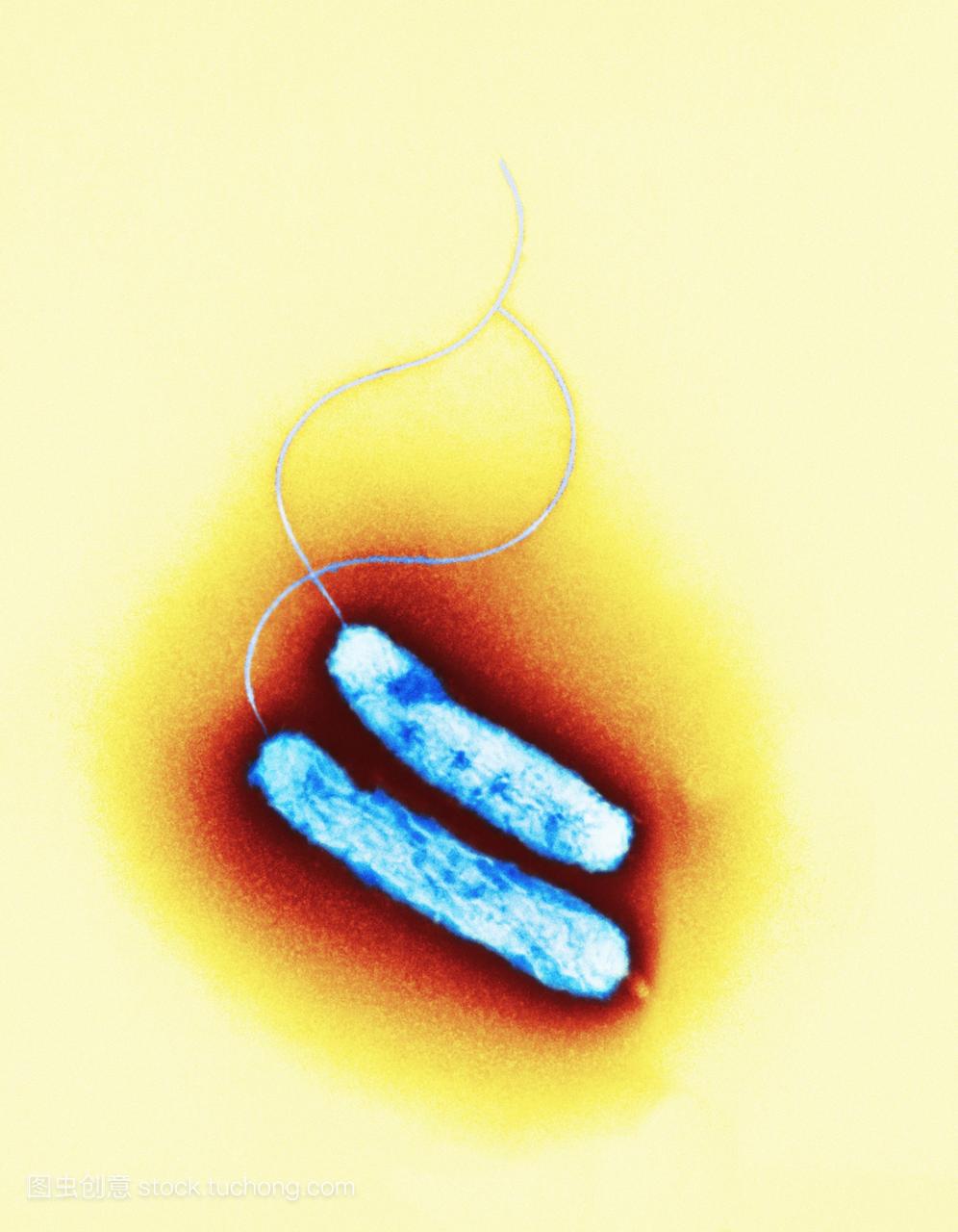 弯曲杆菌的细菌。彩色透射电子显微镜TEM两