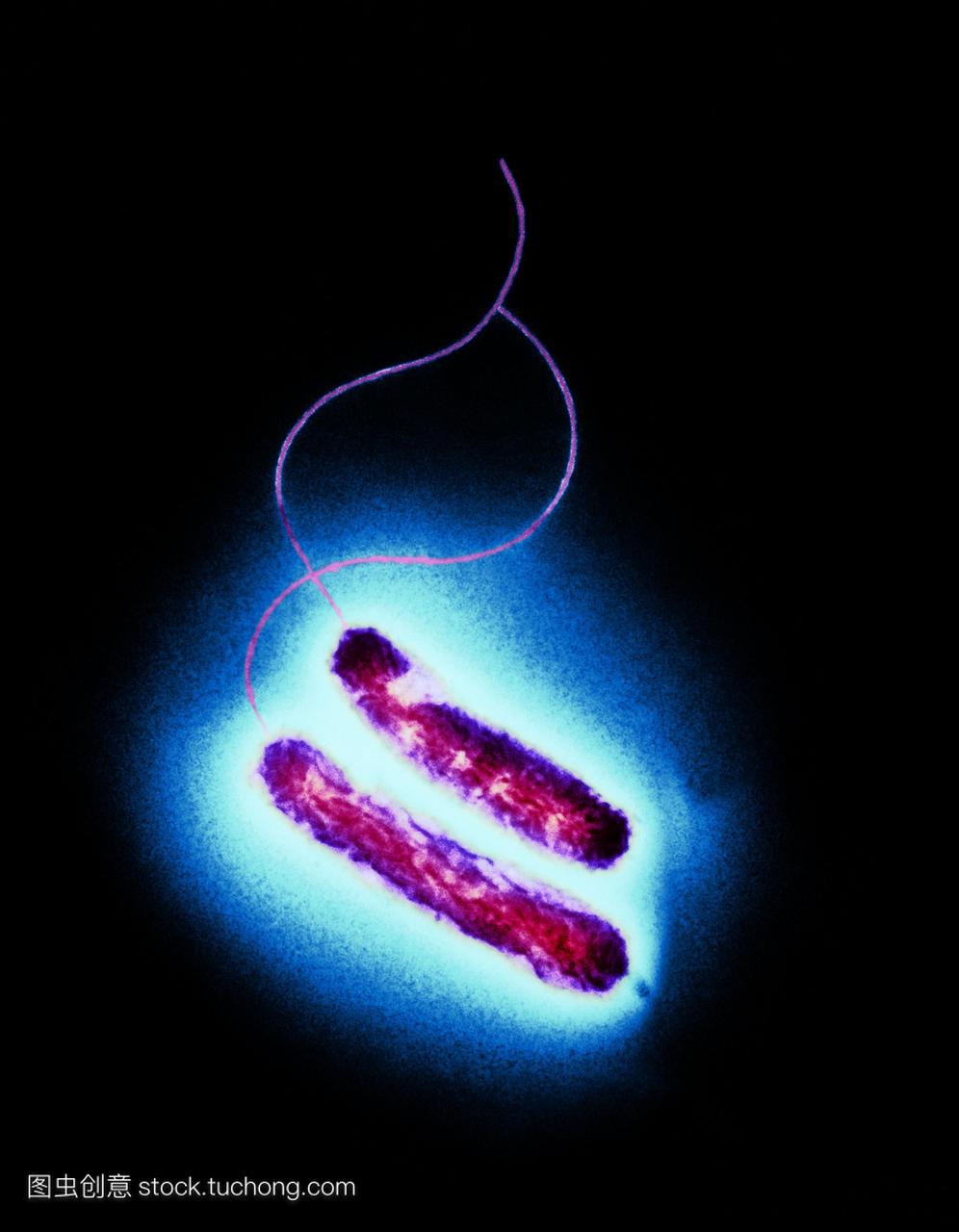 弯曲杆菌的细菌。彩色透射电子显微镜TEM两