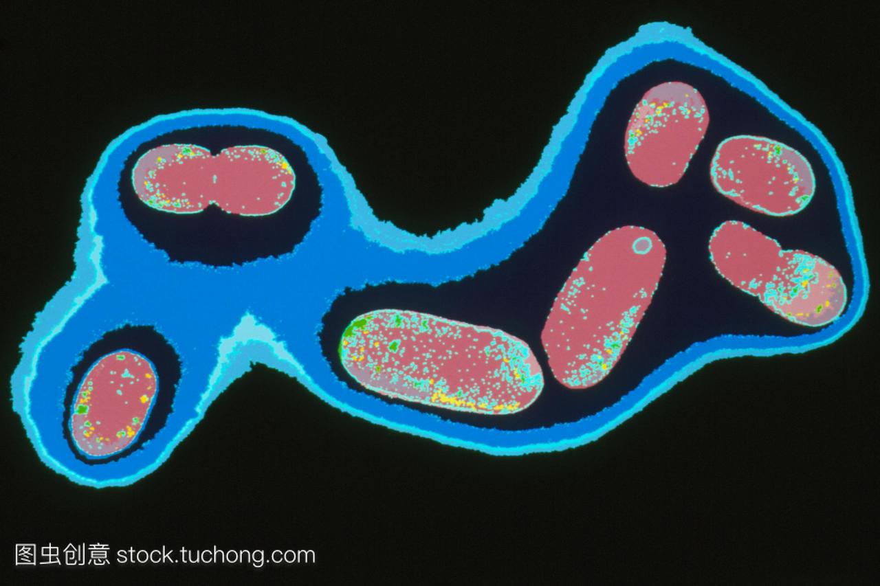 大肠杆菌。彩色透射电子显微镜tem的一种大肠
