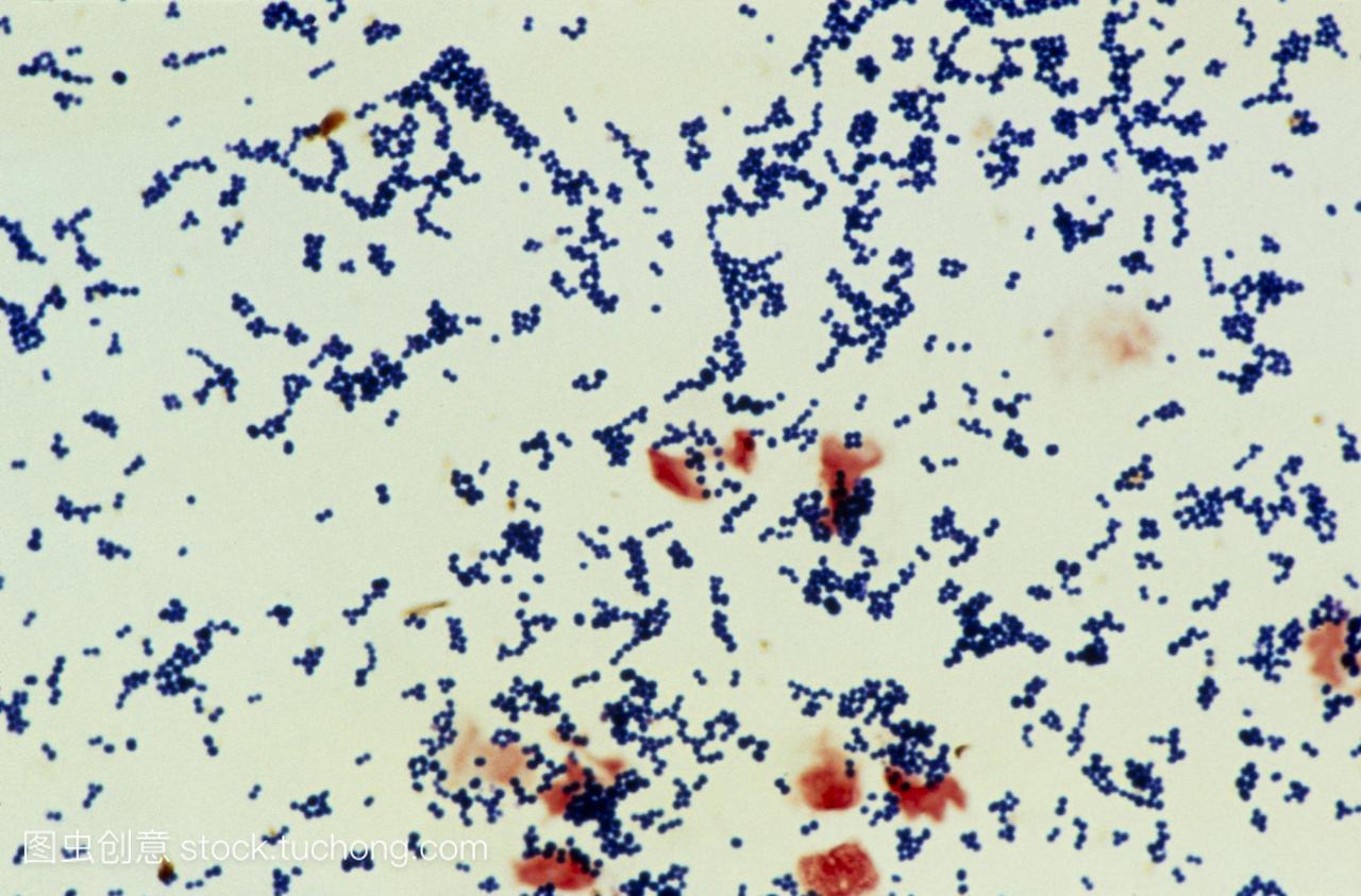 表皮葡萄球菌原albus的光显微照片,在尿液标本