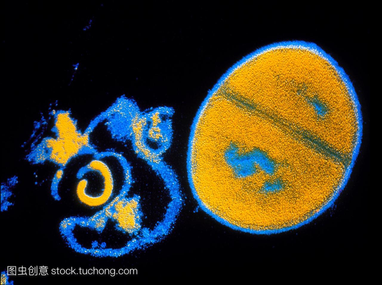 电子显微镜tem显示抗生素对金黄色葡萄球菌的