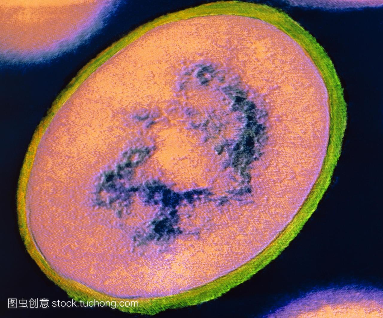 微镜TEM的个体物种的细菌金黄色葡萄球菌属