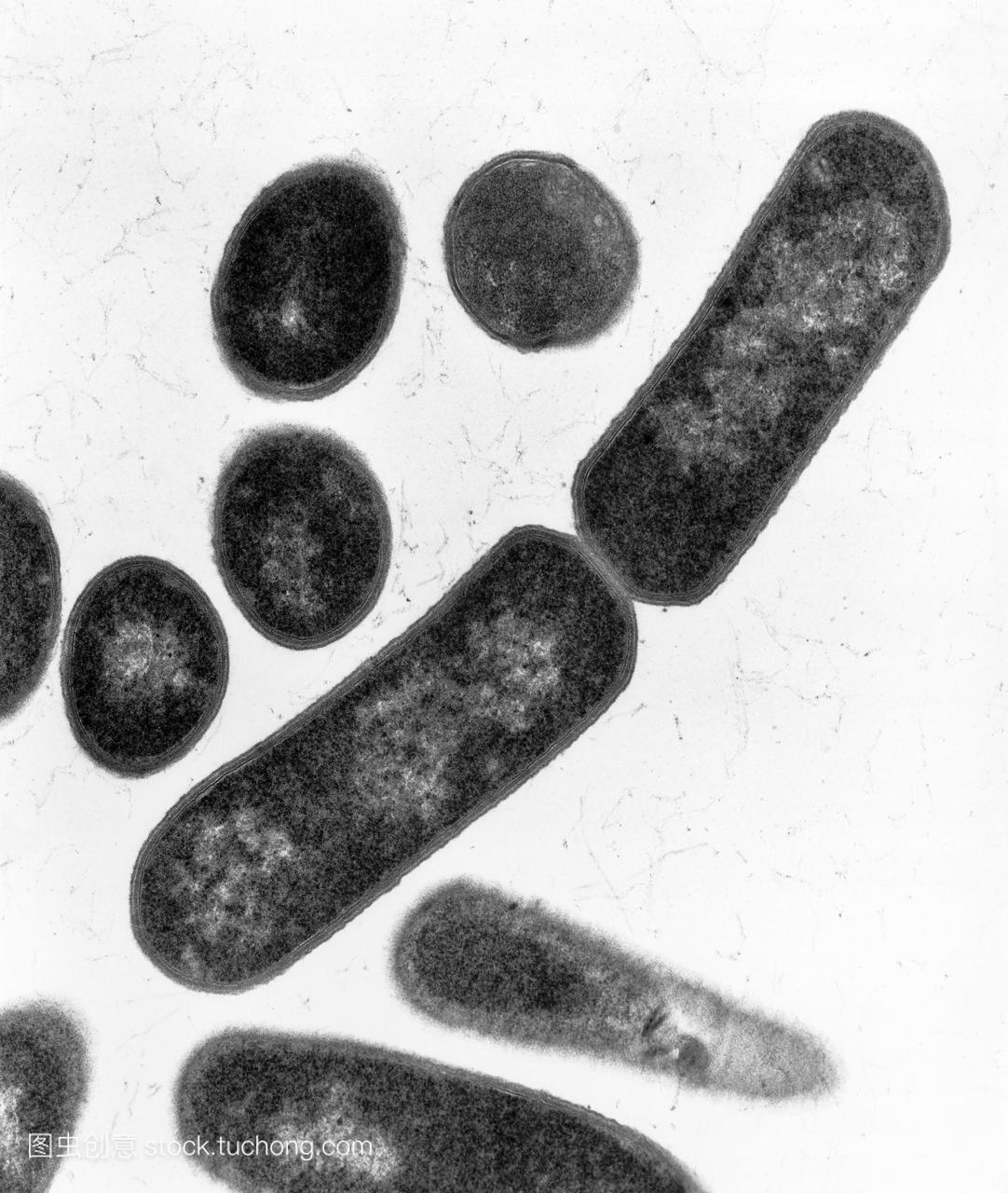 透射电子显微图克--积极的厌氧细菌的肉毒梭菌