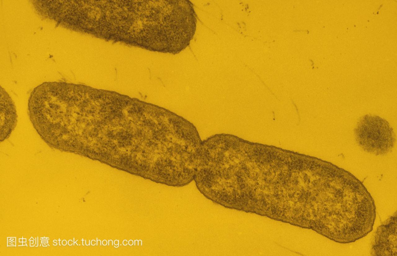 分科早期细菌伤寒沙门氏菌的彩色透射电子显微