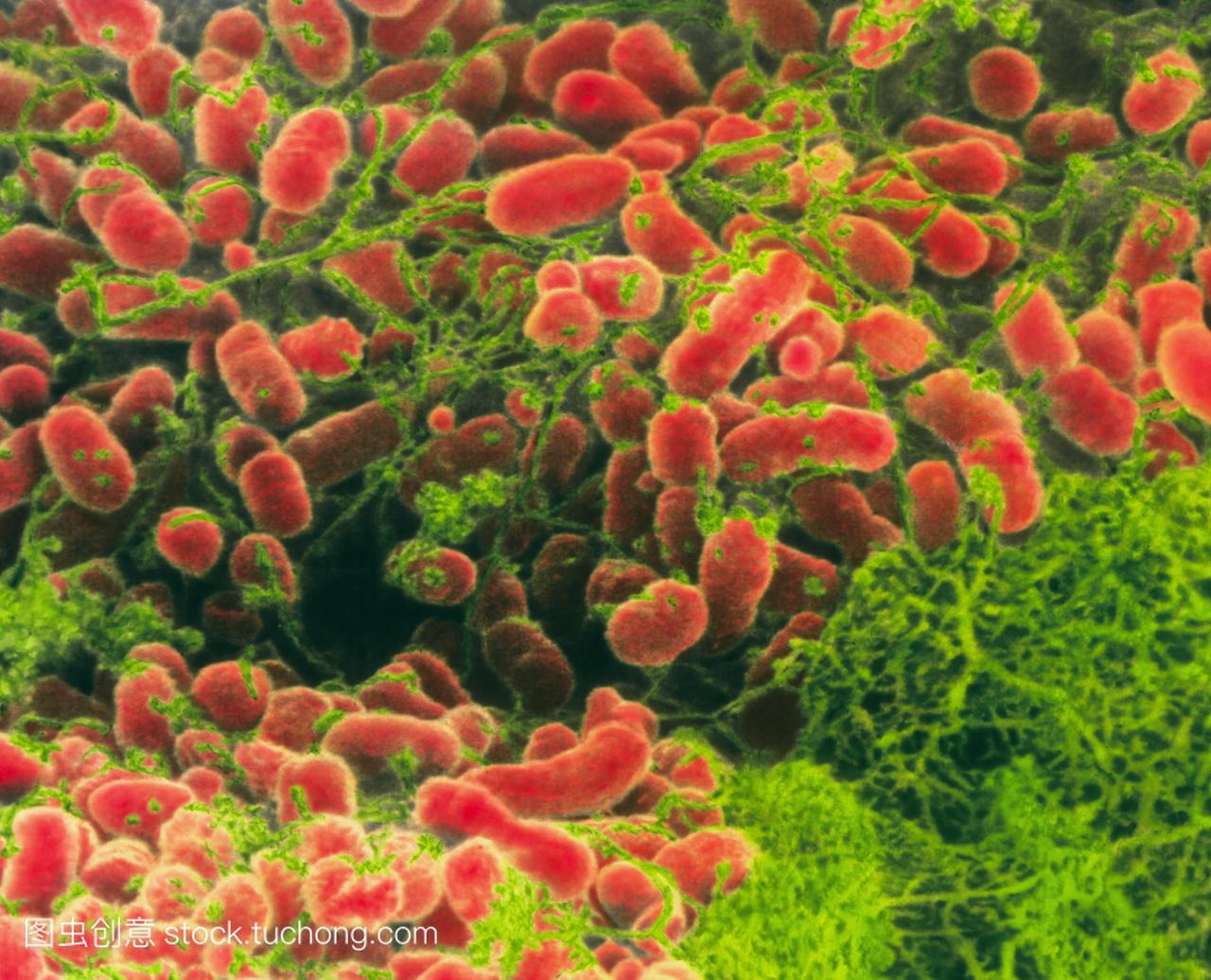 放线杆菌属细菌。彩色扫描电子显微镜sem的细