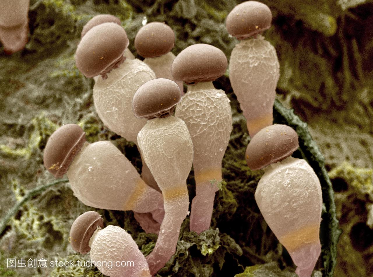 真菌孢囊梗。一种寄生孢子的彩色扫描电子显微