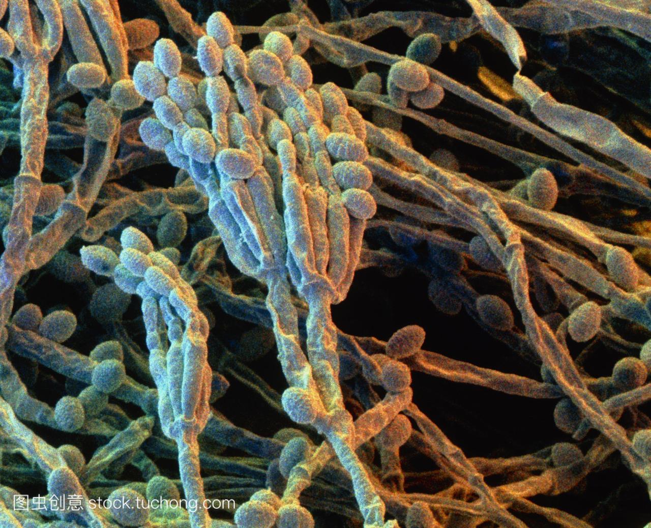 青霉菌。彩色扫描电子显微摄影SEM真菌的菌
