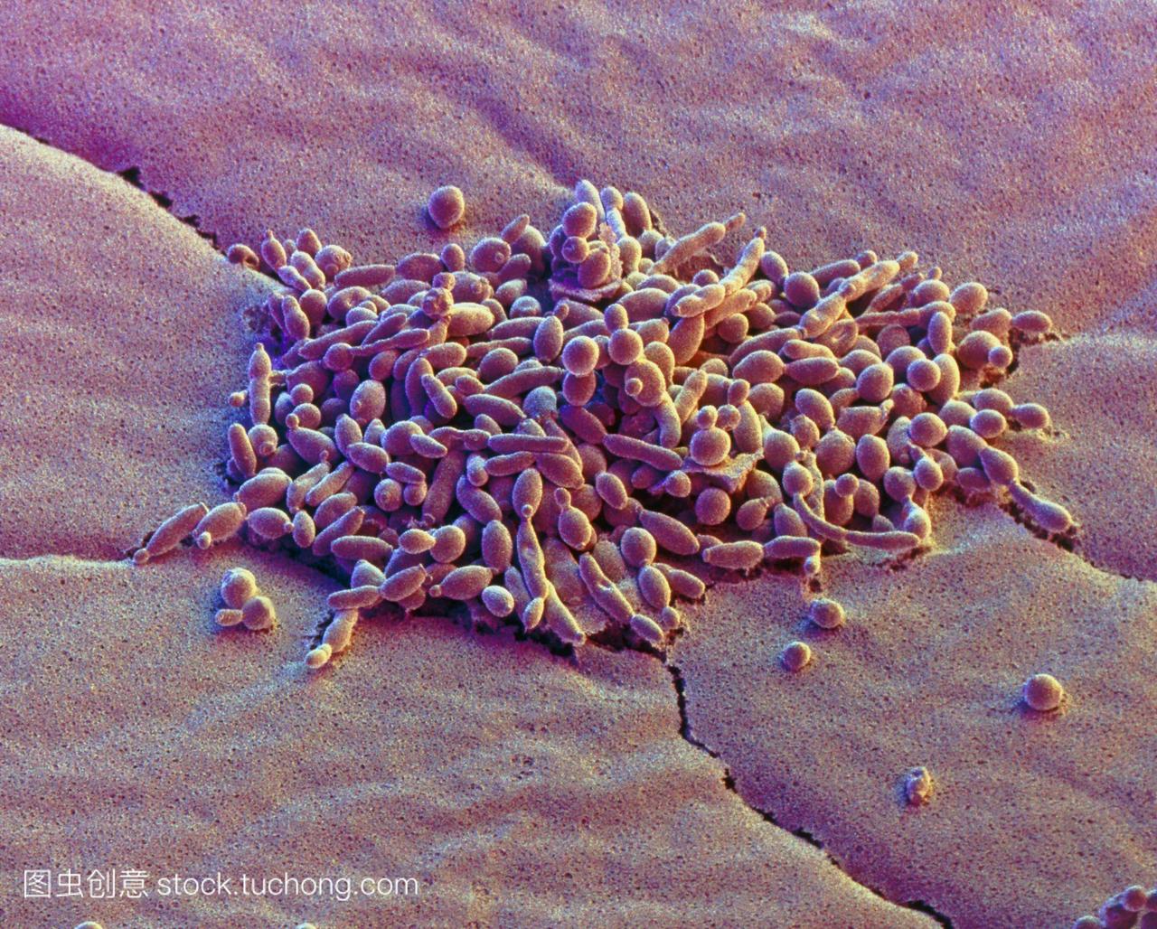 酵母细胞。彩色扫描电子显微镜sem,一群酵母