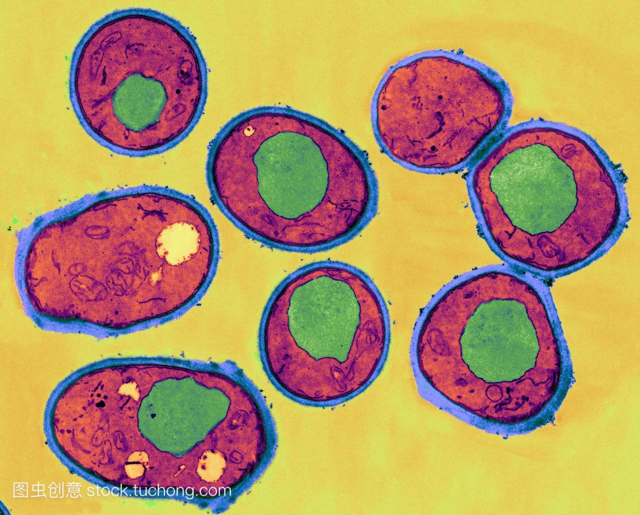 酵母细胞，彩色透射电子显微镜tem。细胞壁呈蓝色，细胞质为红色，液泡为绿色。酵母是一种无性生殖的单细胞真菌。一些酵母被用于烘焙和酿造工业，但有些是致病性的。