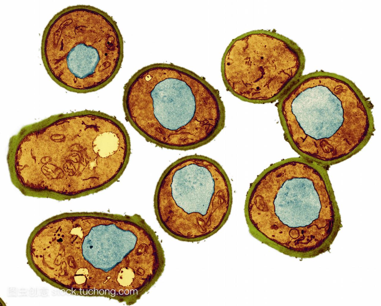 酵母细胞彩色透射电子显微镜TEM。细胞壁所