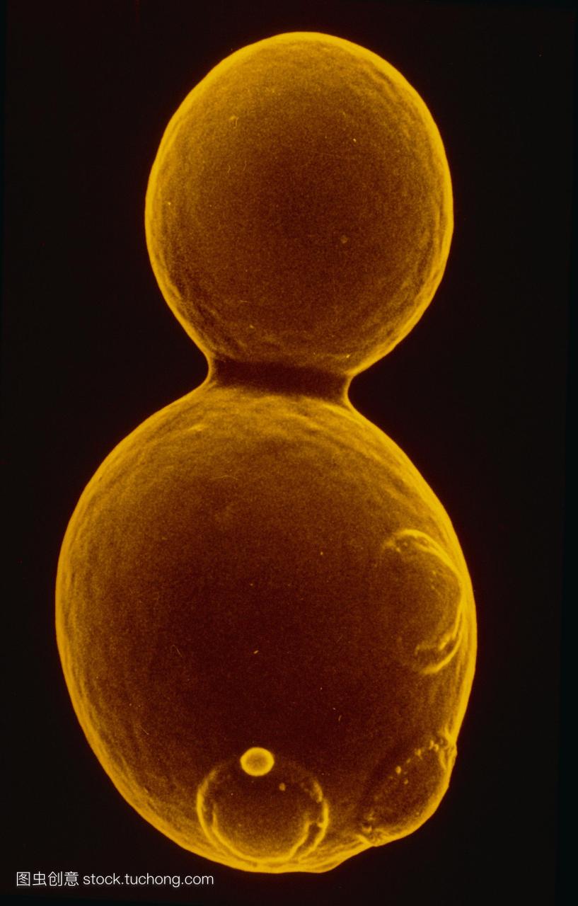 芽殖酵母的假彩色扫描电子显微图。酵母是单细