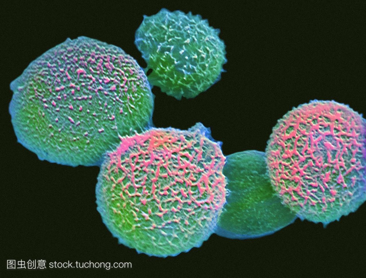 新型隐球菌。新隐球菌真菌细胞的彩色扫描选择