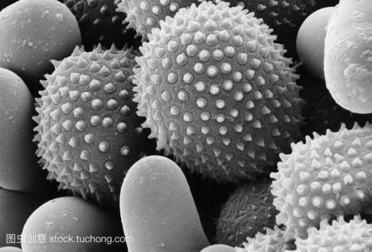 玫瑰锈真菌孢子。扫描电子显微照片的生殖孢子
