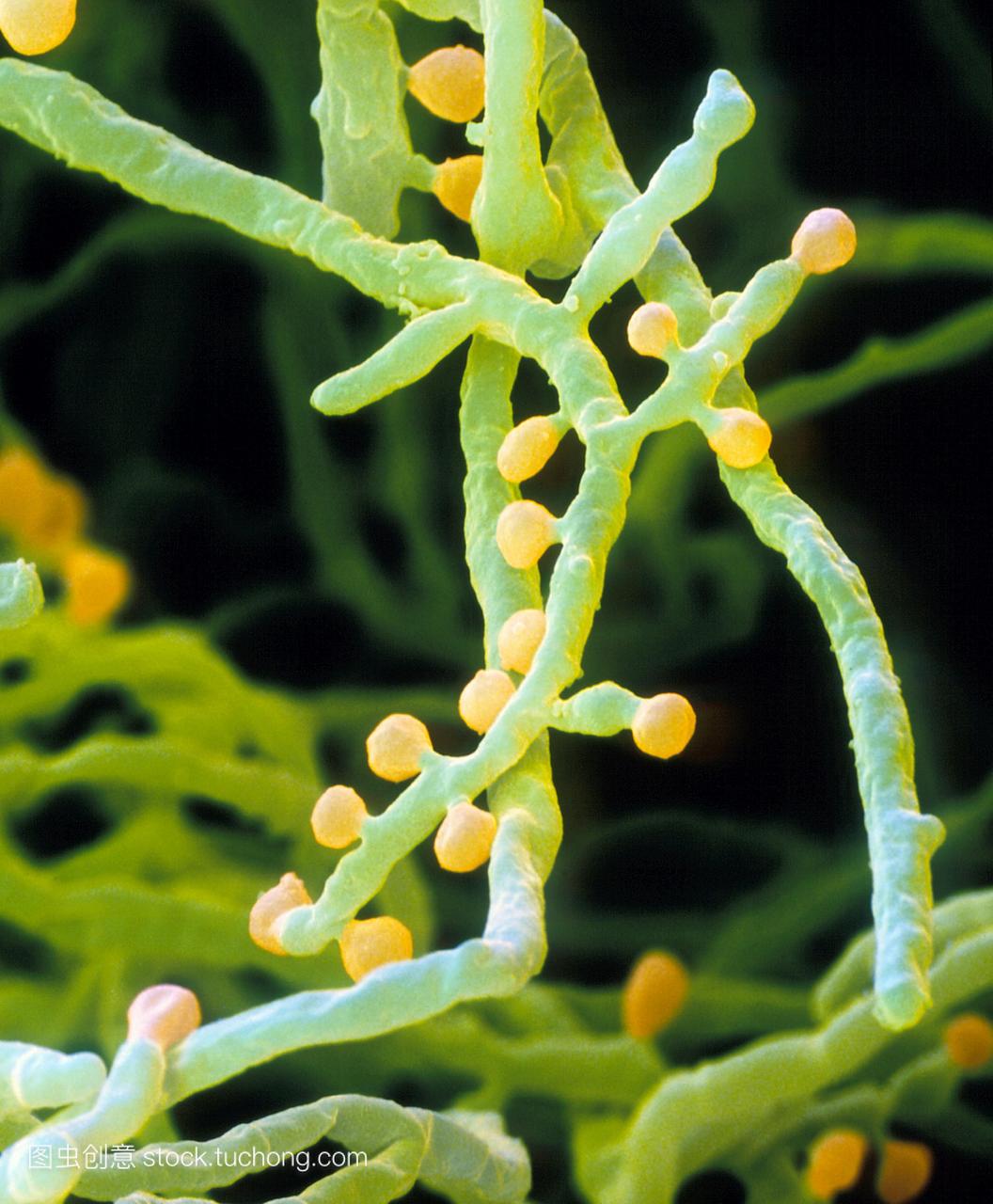 ytes。彩色扫描电子显微摄影毛癣菌属的真菌m