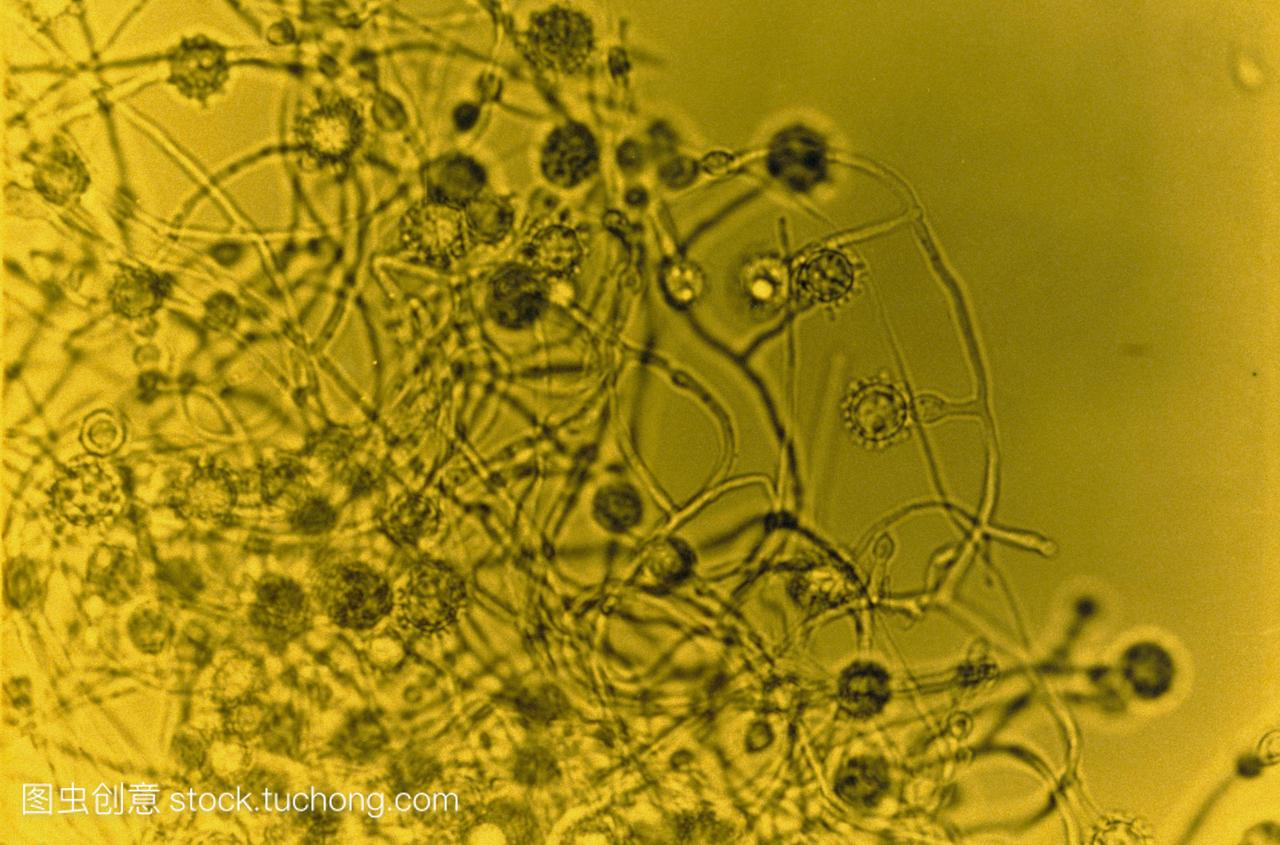 一种寄生的,酵母状真菌的假彩色光微图,被称为