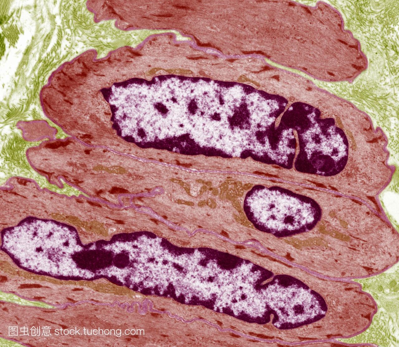 肠道平滑肌细胞彩色透射电子显微镜tem的部分