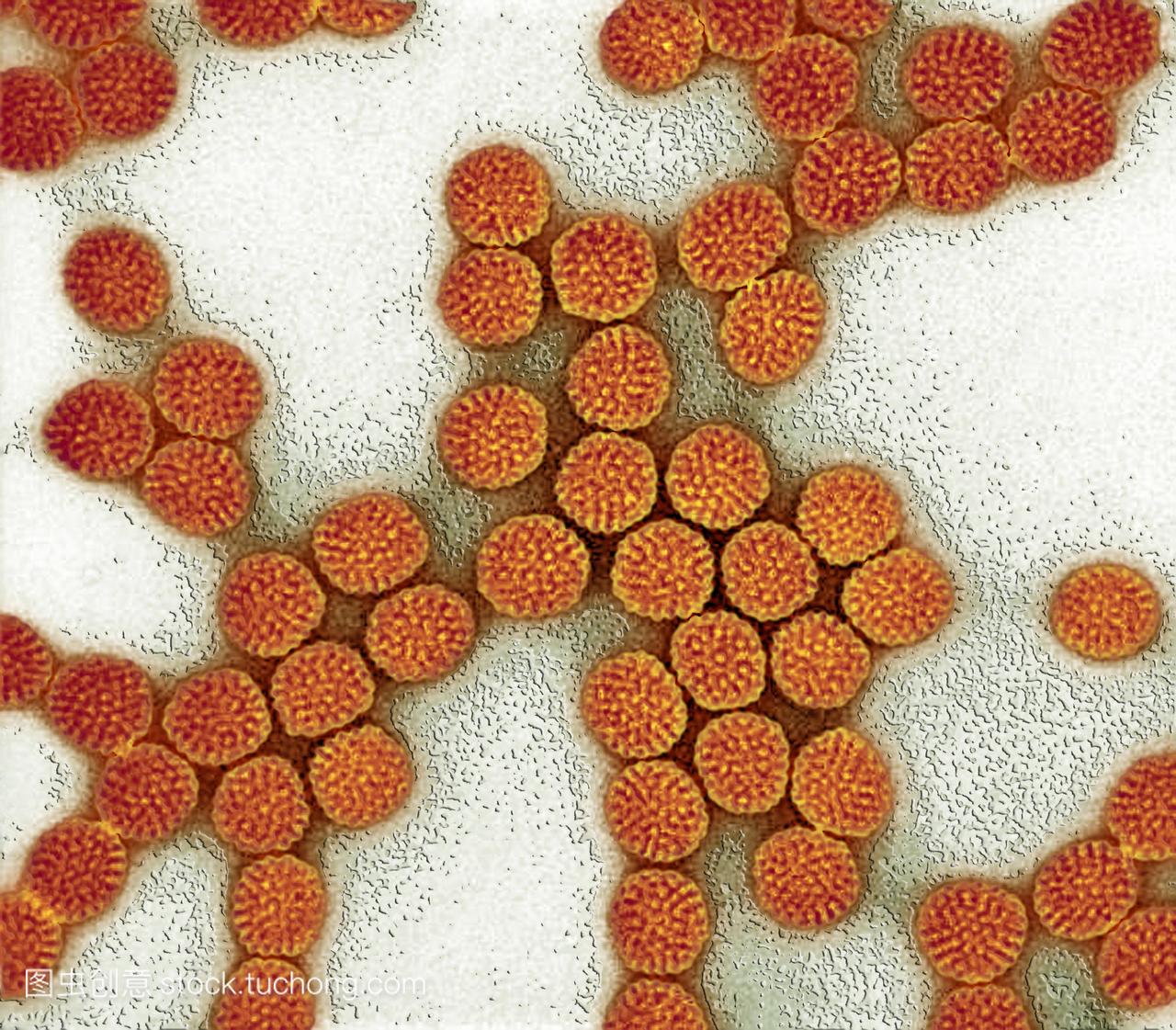 轮状病毒粒子。轮状病毒粒子橙色的彩色透射电