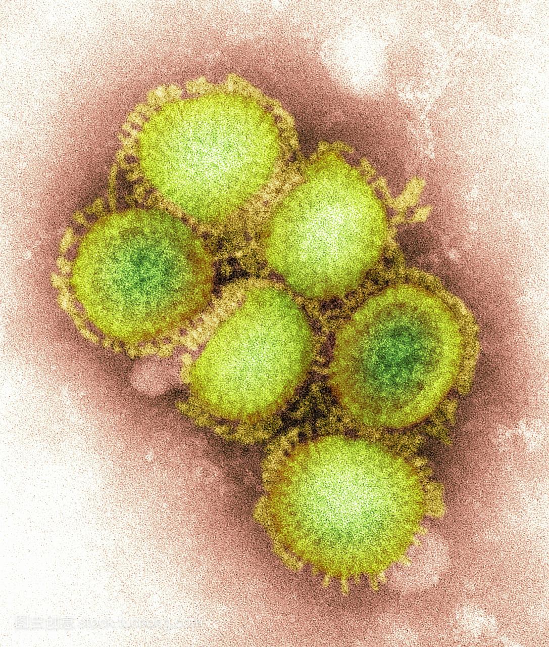 哥城。猪流感是由a型流感病毒引起的猪呼吸道