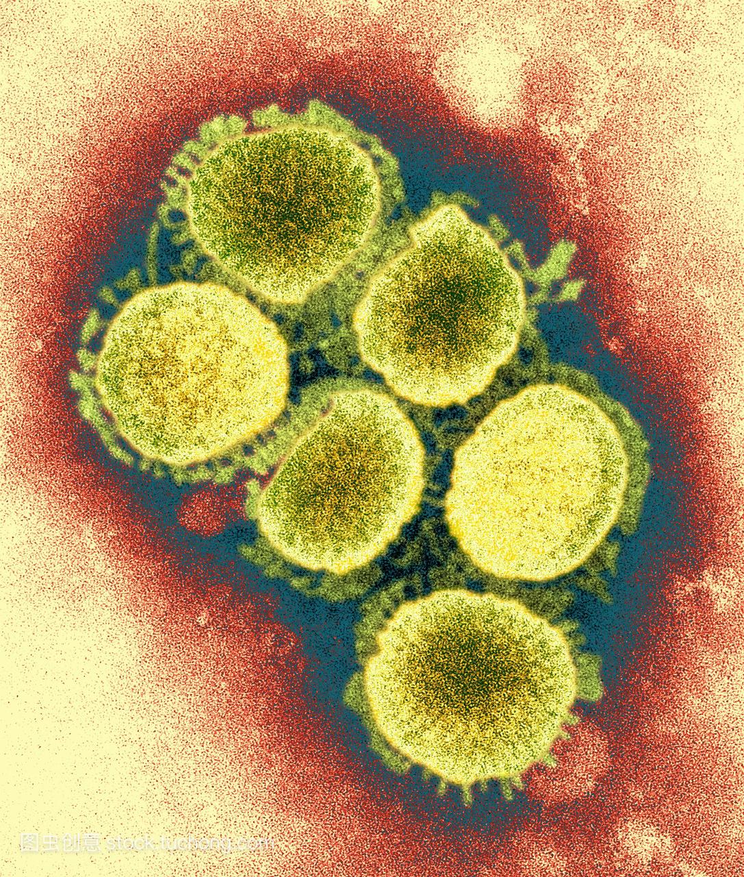 h1n1猪流感病毒。从2009年4月起爆发的猪流感