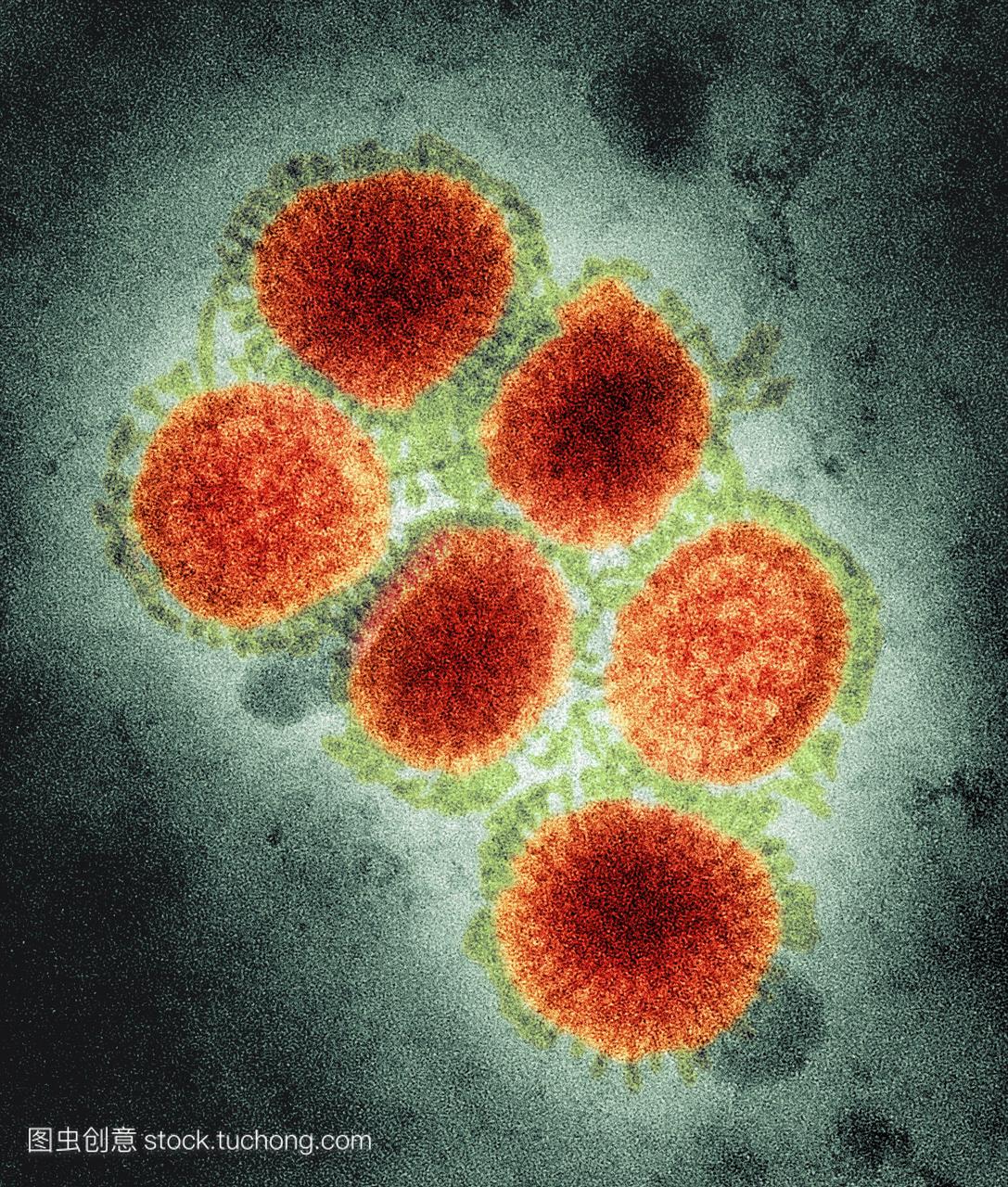H1N1猪流感病毒。彩色透射电子显微镜(TEM)