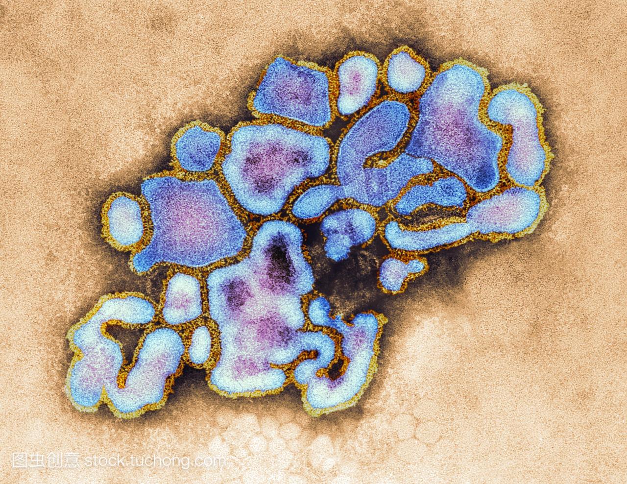 猪流感病毒。彩色透射电子显微镜TEM猪流感
