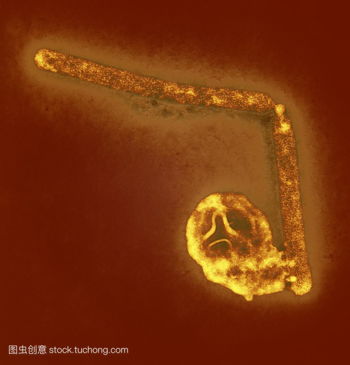 禽流感病毒粒子。彩色透射电子显微镜TEMaH