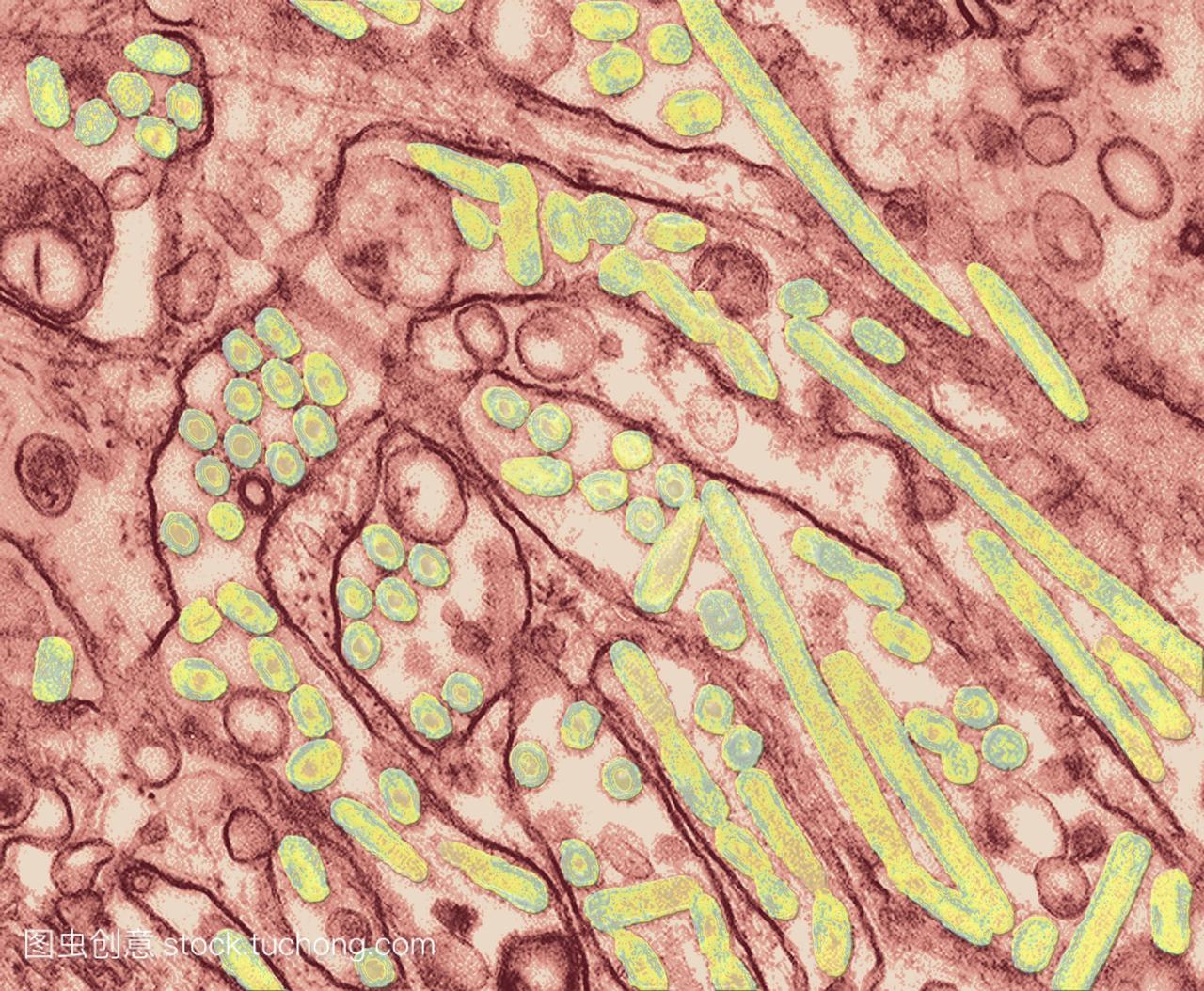 H5N1型禽流感病毒粒子彩色透射电子显微镜T