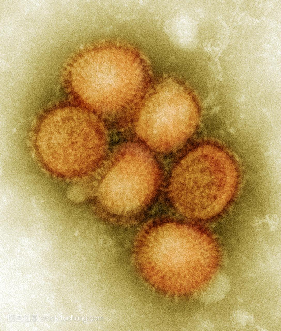 H1N1猪流感病毒。彩色透射电子显微镜TEM猪