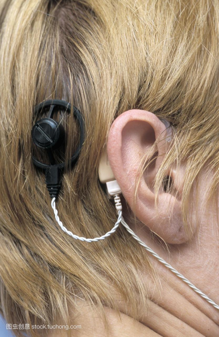 妇女戴的耳蜗植入物的近距离。声音处理器(米