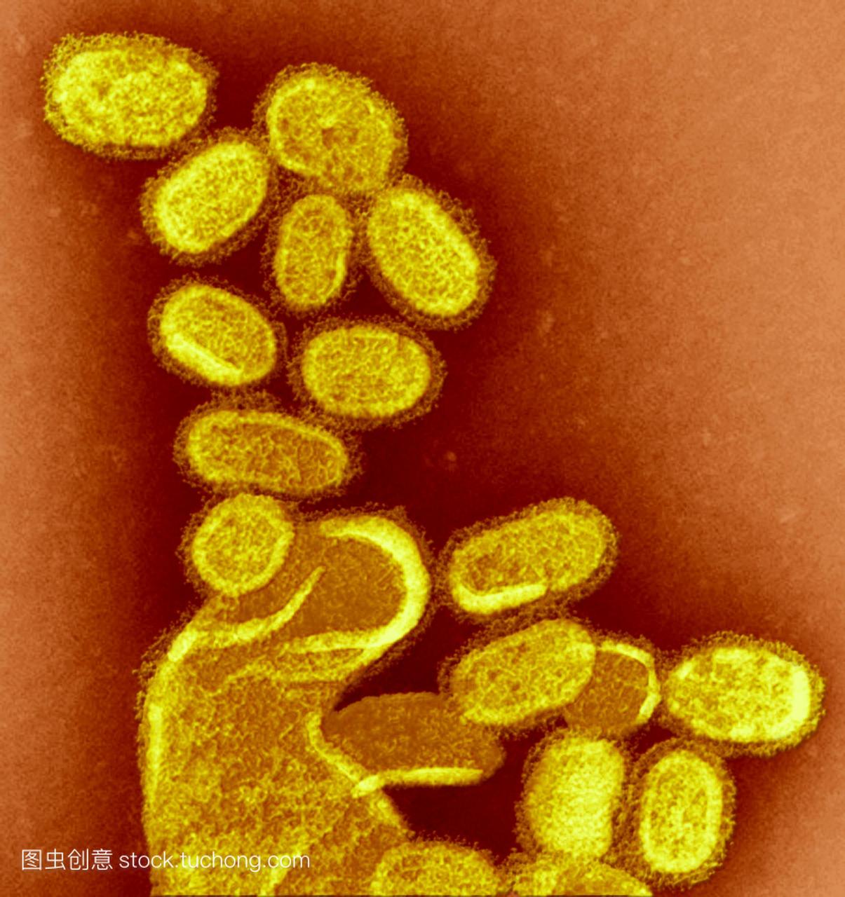 1918h1n1流感病毒粒子彩色透射电子显微镜te