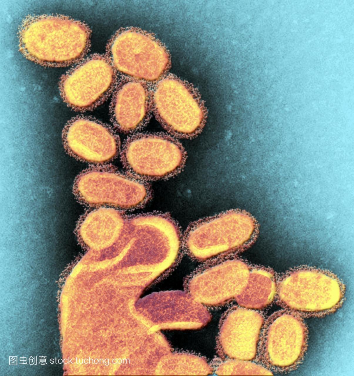 1918h1n1流感病毒粒子彩色透射电子显微镜te