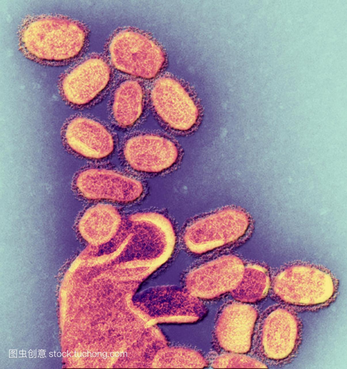 1918年h1n1流感病毒粒子,彩色透射电子显微照