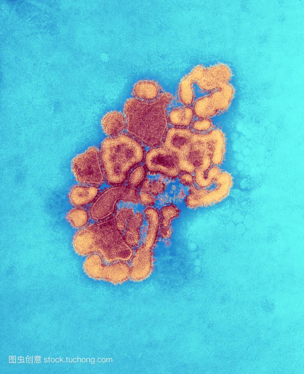猪流感病毒。彩色透射电子显微镜TEM猪流感