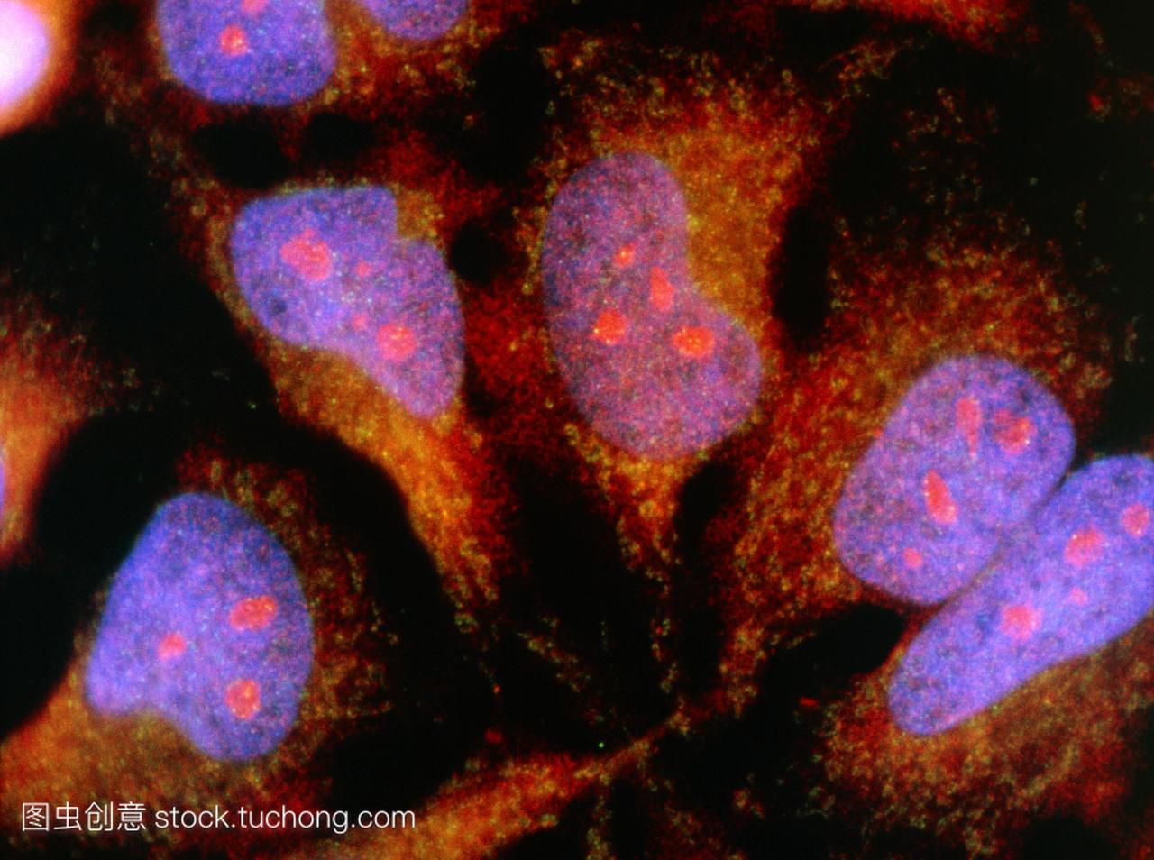 照片培养希拉癌细胞。每个细胞的细胞核染色蓝
