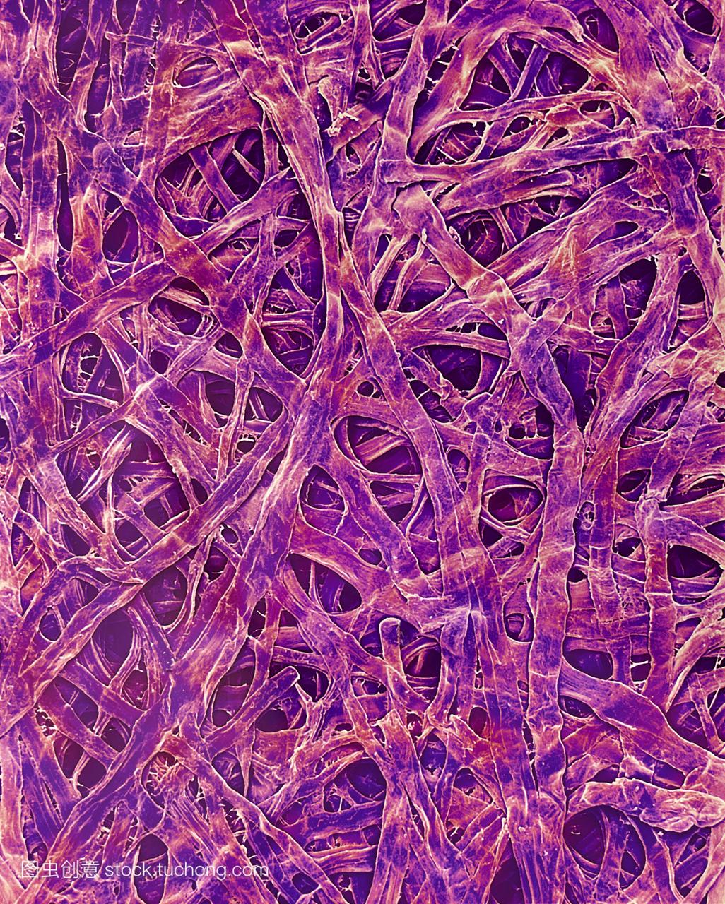 海藻纤维纸彩色扫描电子显微摄影SEM。许多